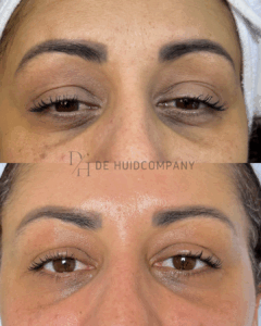 Instagram Portrait Post (45)